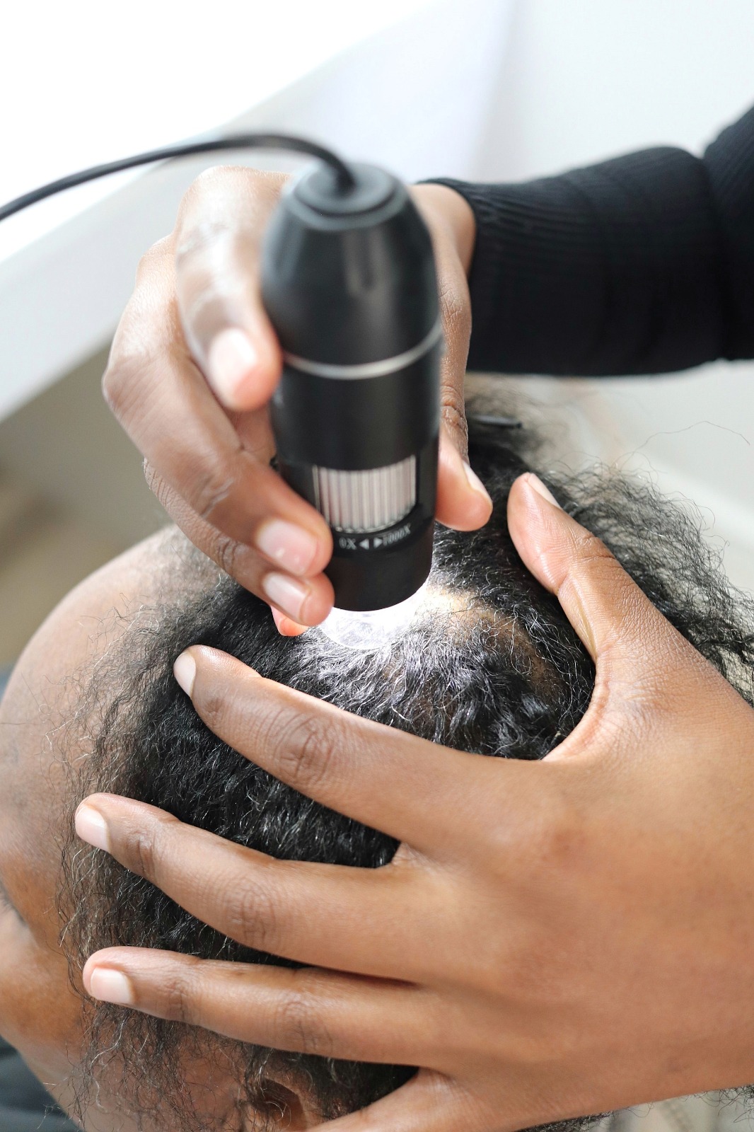 Scalp analysis